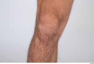 Turgen knee nude 0004.jpg